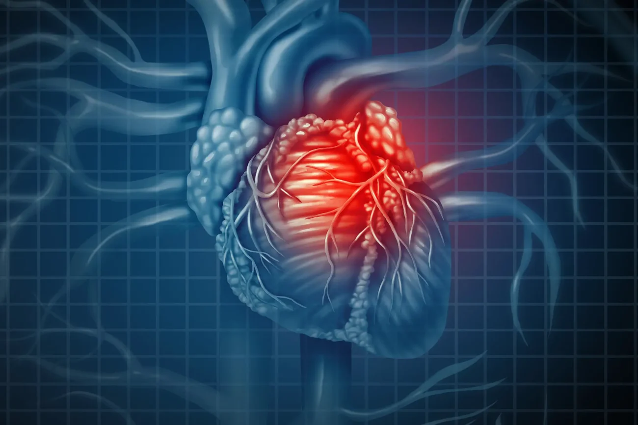 Cardiovascular Health